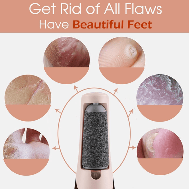 "Flawless" električna turpija za stopala - Zoro