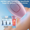 IPL Laserski Epilator "JDK-881" - Zoro
