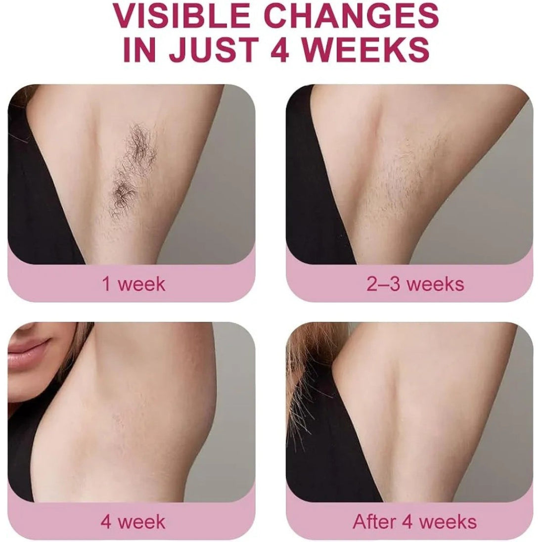 IPL Laserski Epilator "JDK-881" - Zoro