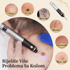 Plasma Pen Aparat za Uklanjanje Mladeža, Bradavica i Pjegica - Zoro