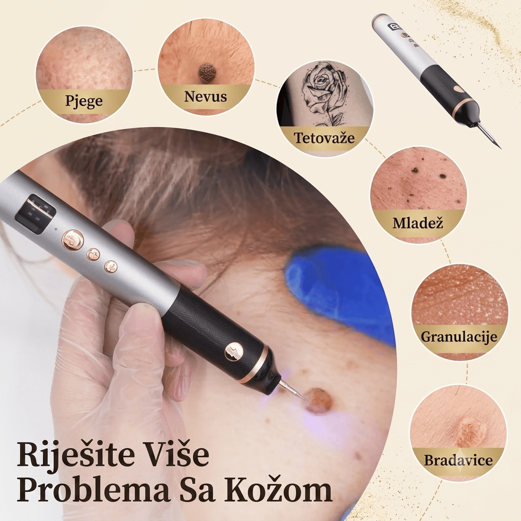 Plasma Pen Aparat za Uklanjanje Mladeža, Bradavica i Pjegica - Zoro