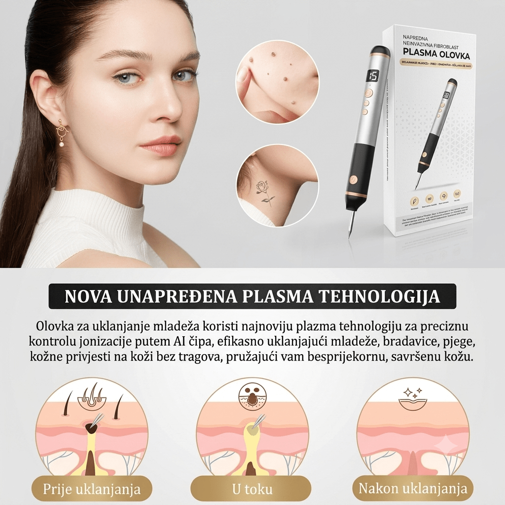 Plasma Pen Aparat za Uklanjanje Mladeža, Bradavica i Pjegica - Zoro