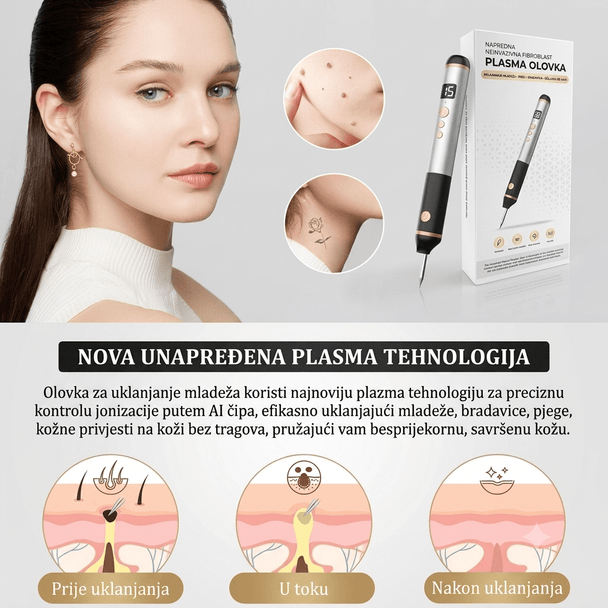 Plasma Pen Aparat za Uklanjanje Mladeža, Bradavica i Pjegica - Zoro
