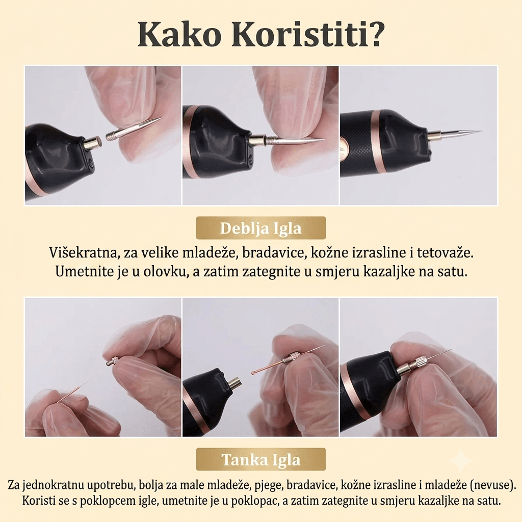 Plasma Pen Aparat za Uklanjanje Mladeža, Bradavica i Pjegica - Zoro